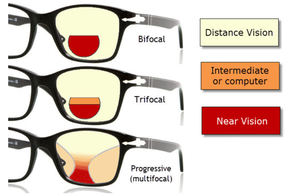 Lens types